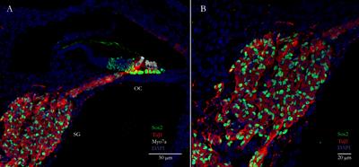 Reprogramming Glia Into Neurons in the Peripheral Auditory System as a Solution for Sensorineural Hearing Loss: Lessons From the Central Nervous System